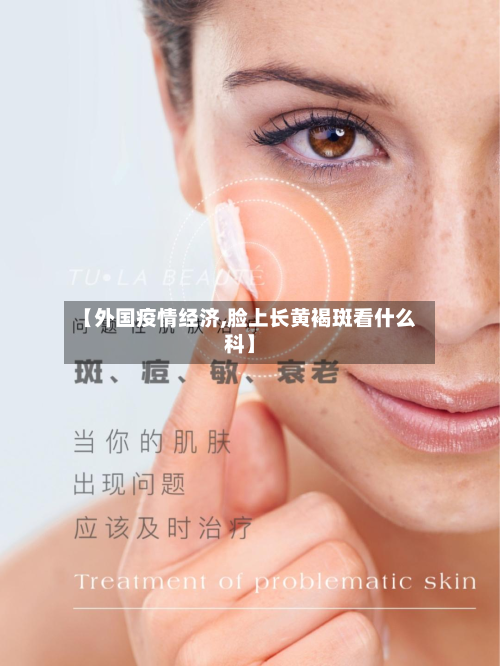 【外国疫情经济,脸上长黄褐斑看什么科】-第1张图片