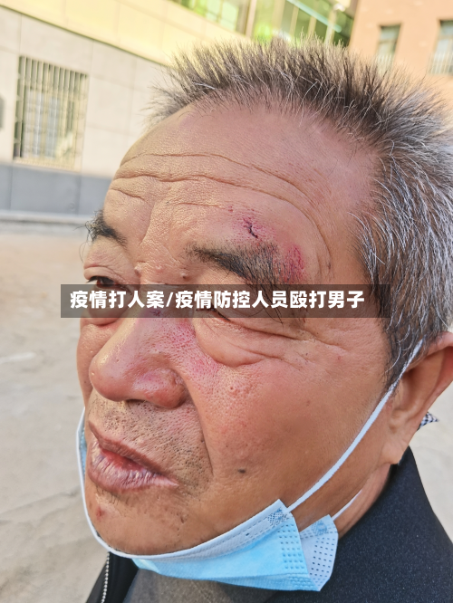 疫情打人案/疫情防控人员殴打男子-第3张图片